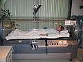 Hyperbaric oxygen therapy.JPG